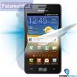 Screenshield fólie na celé tělo pro Samsung Galaxy W (i8150)